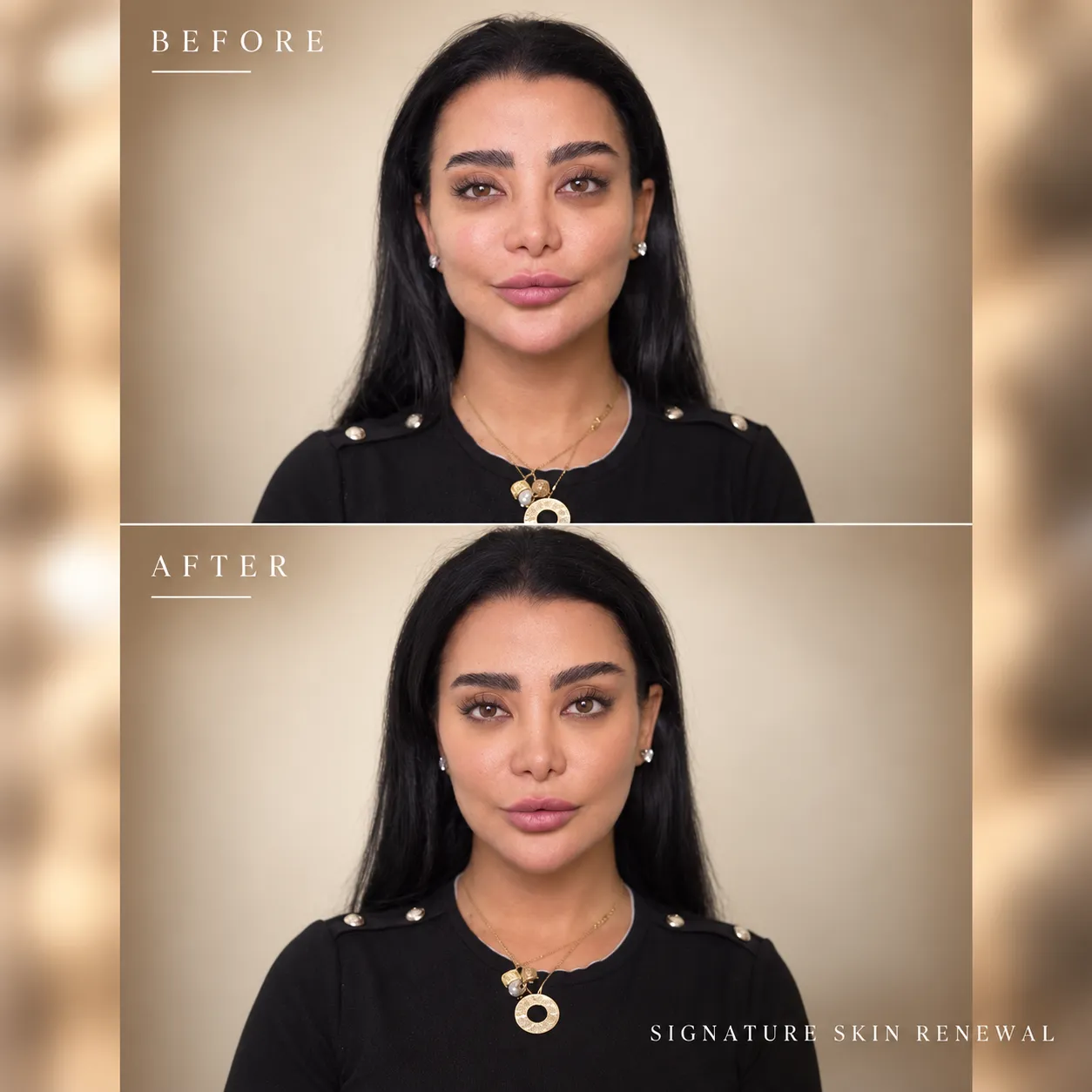 Before and After Skin Renewal (1)_11zon