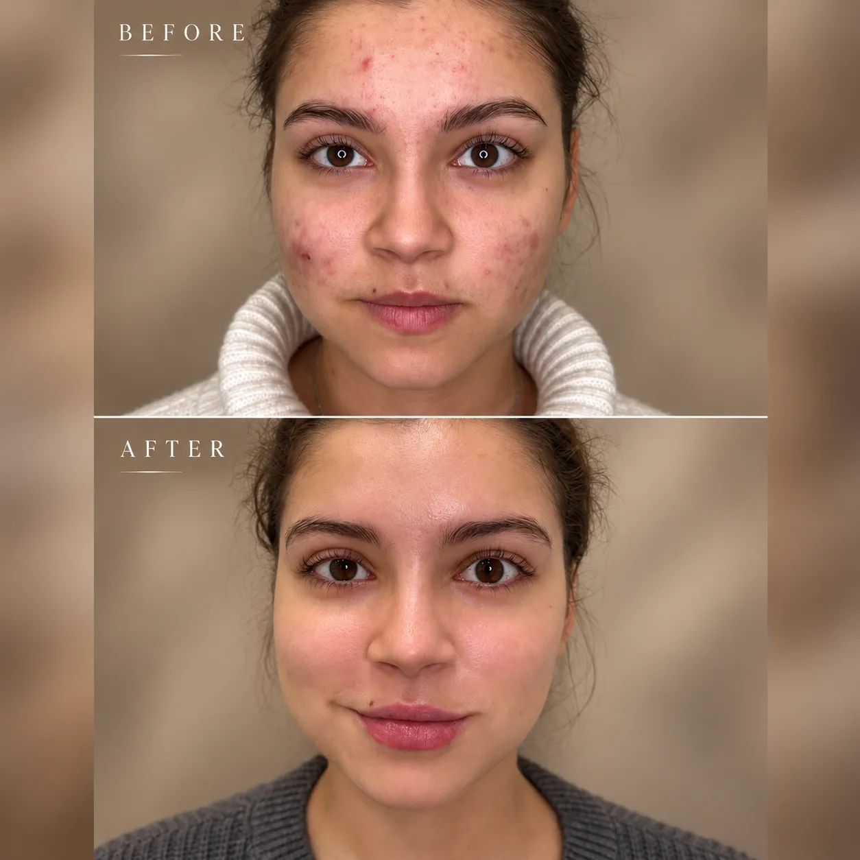 Before and After Skincare Portrait_11zon