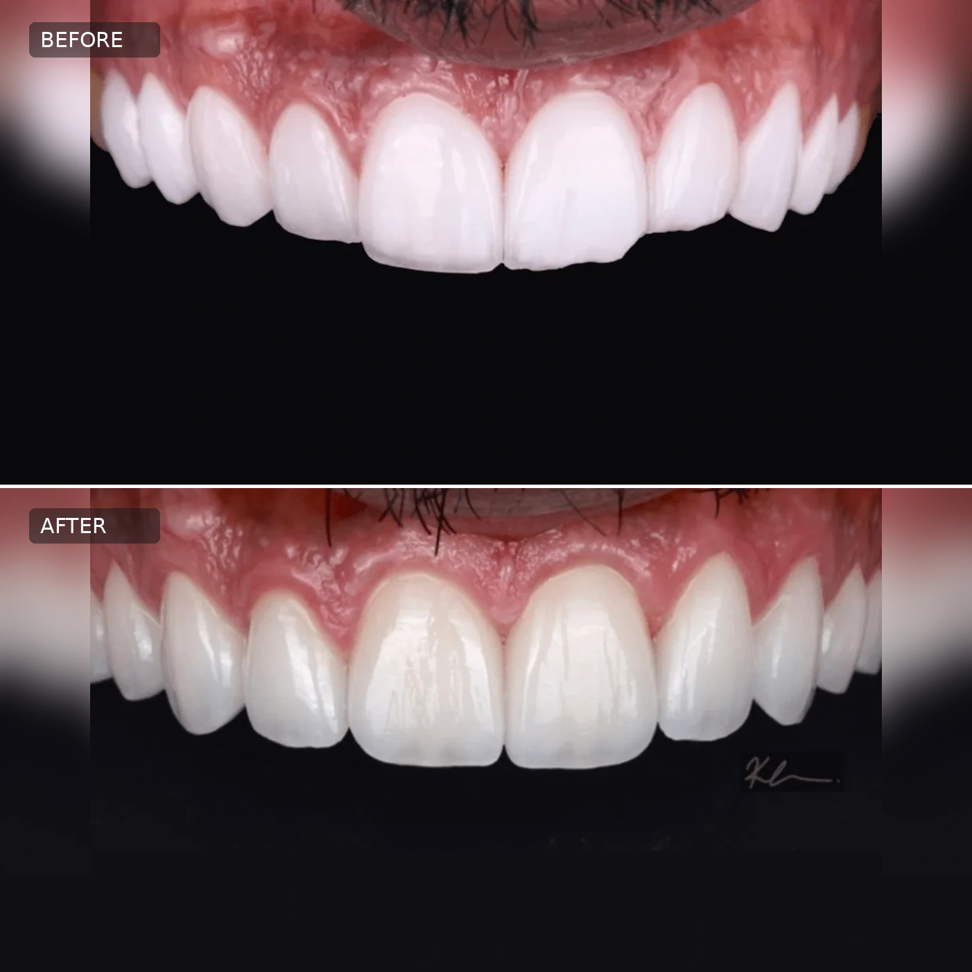 Dental Before-After 01