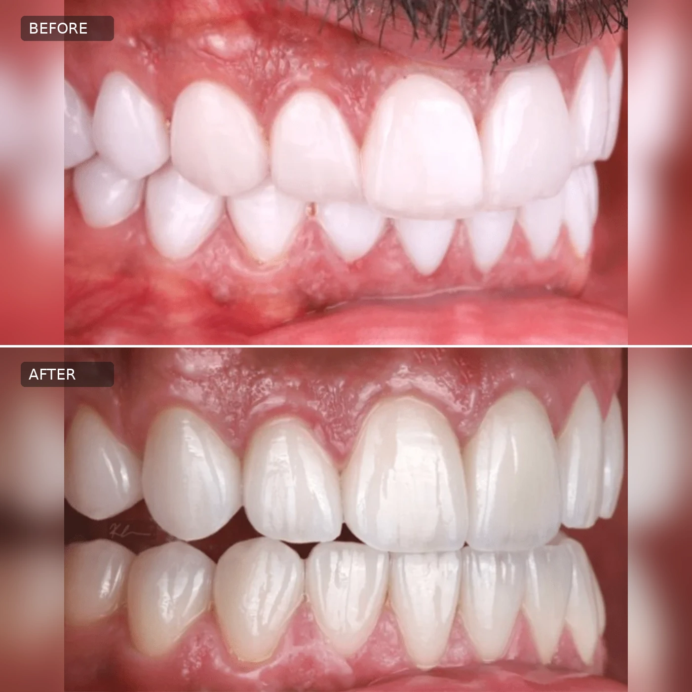 Dental Before-After 02