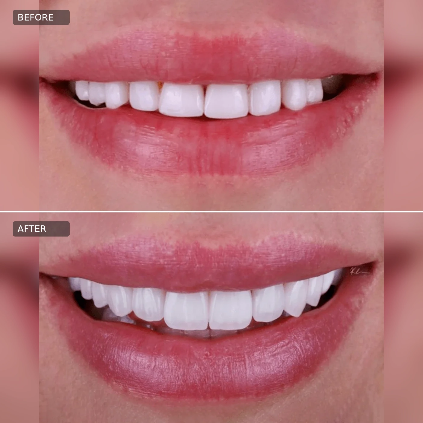 Dental Before-After 03