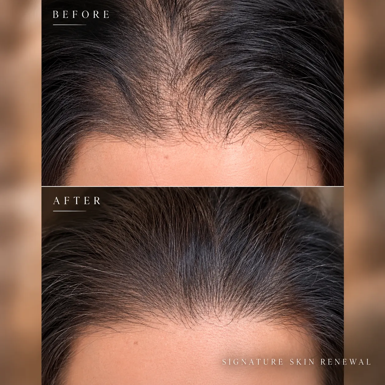 Hairline Transformation Before and After_11zon
