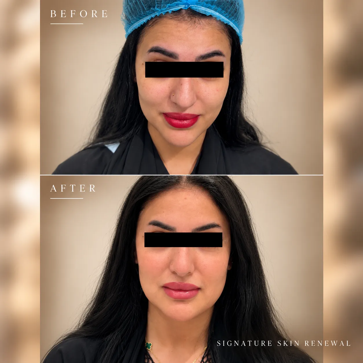 Signature Skin Renewal Comparison_11zon