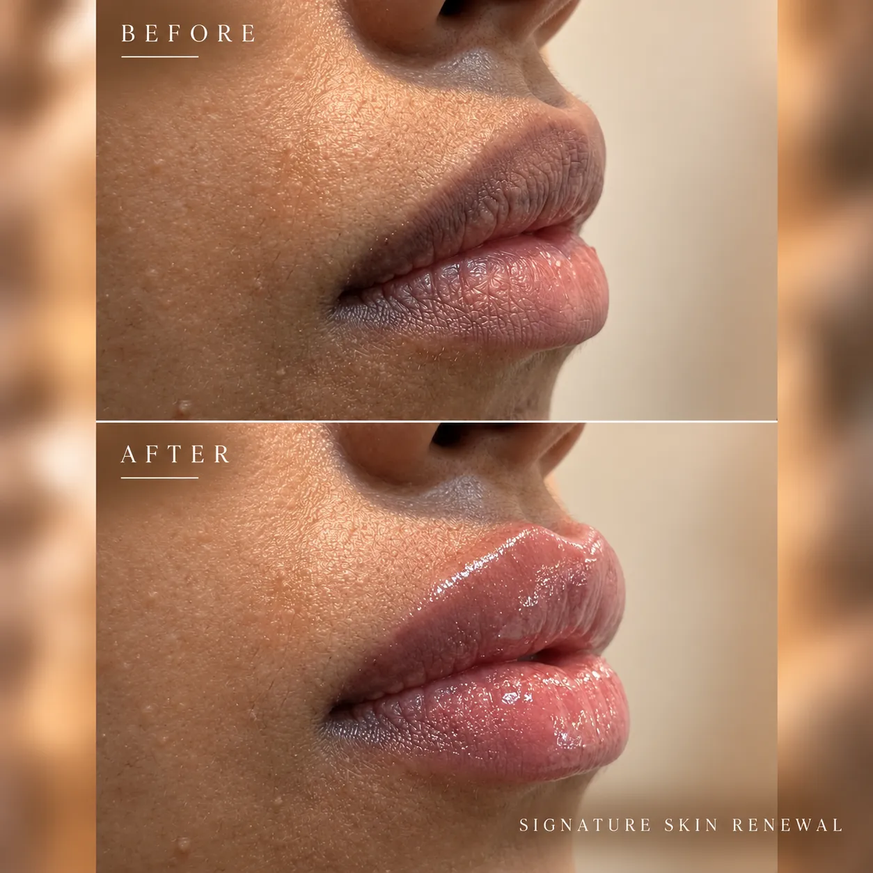 Signature Skin Renewal_ Before & After_11zon