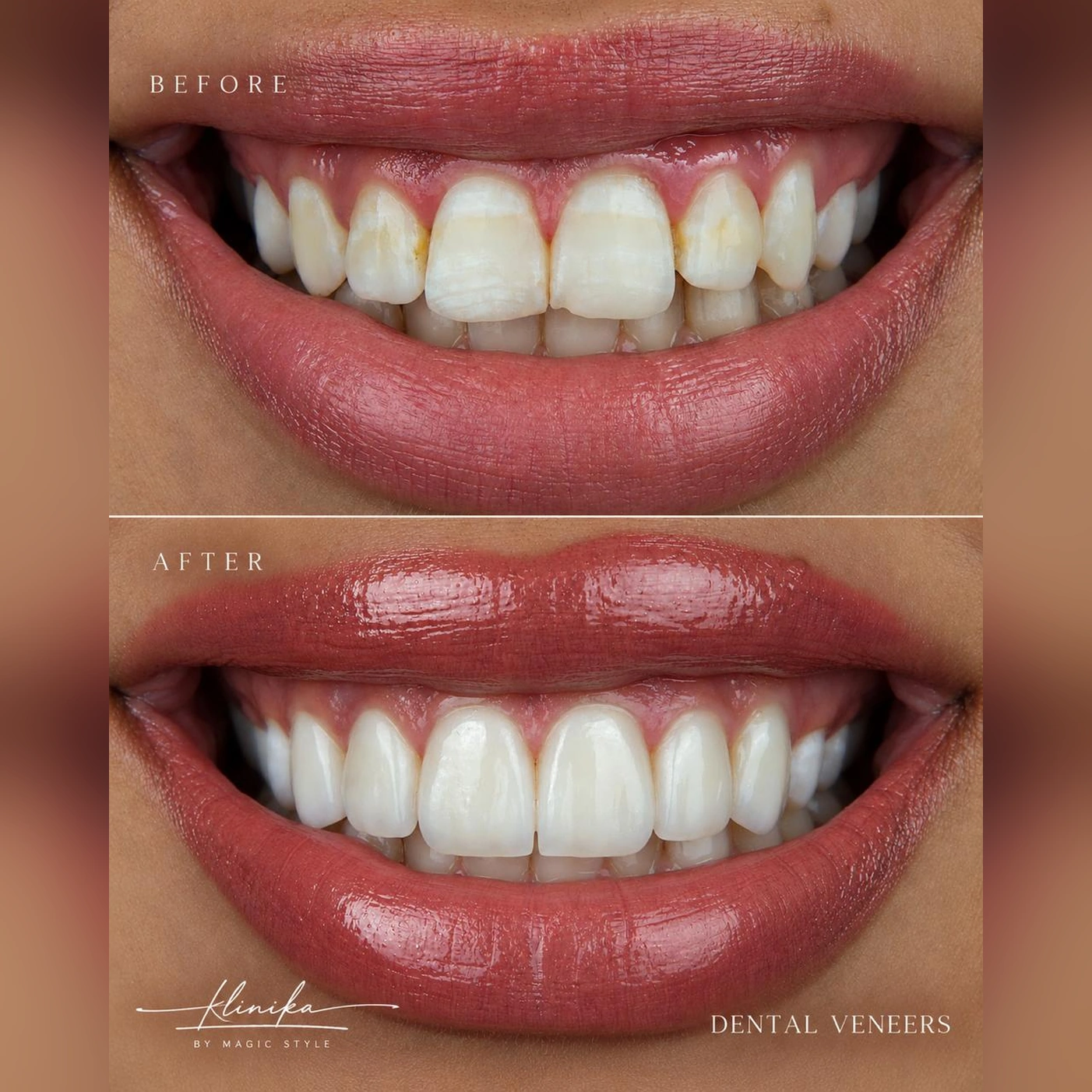 Smile Comparison 01 - Square
