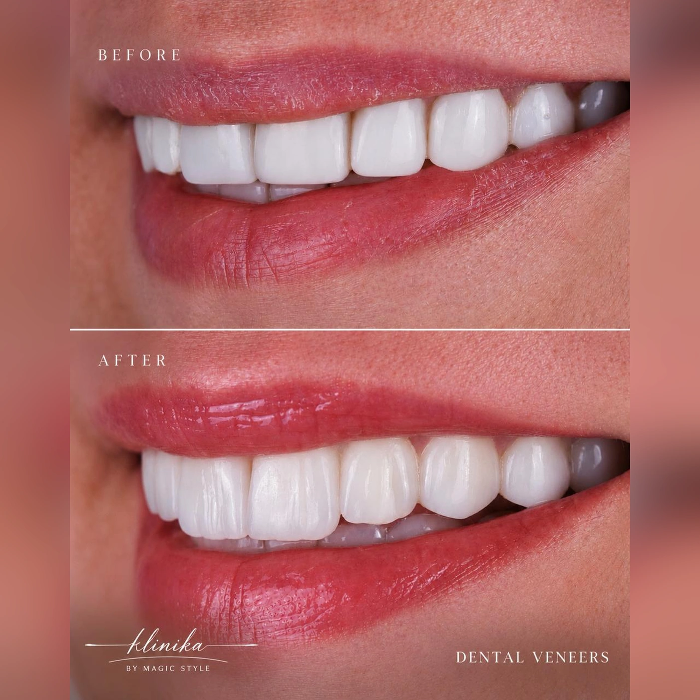 Smile Comparison 02 - Square